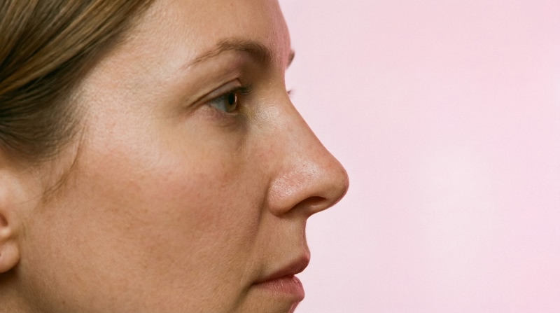 Foto antes de Explante de Silicone realizado por Dr. Fernando Pro Plan