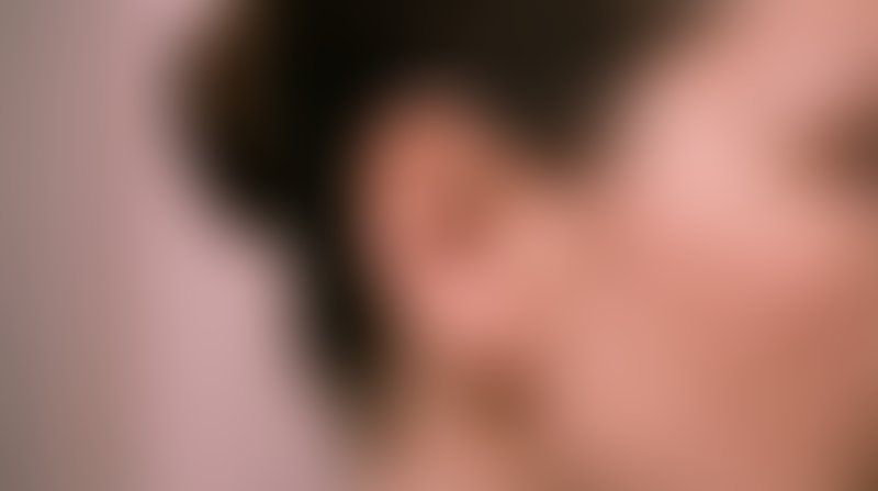 Foto antes de Mamoplastia de Aumento realizado por Dr. José Fernando