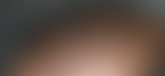 Resultado após Mamoplastia de Aumento realizado por Dr. Fábio Vieira